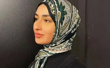 MasterChef Beyza Huri Aydın’dan estetik açıklaması: ‘Asla yaptırmam!’